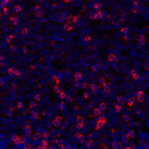 TIGIT Antibody in Immunohistochemistry (Paraffin) (IHC (P))