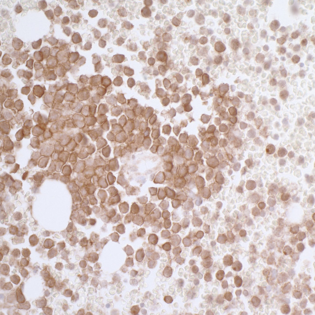 CD33 Antibody in Immunohistochemistry (Paraffin) (IHC (P))