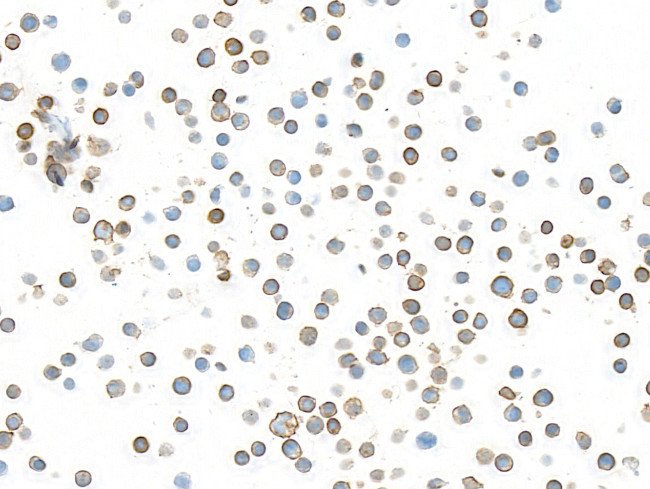 DNAM-1/CD226 Antibody in Immunocytochemistry (ICC/IF)