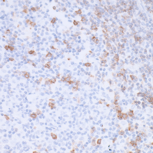 PD-1 Antibody in Immunohistochemistry (Paraffin) (IHC (P))