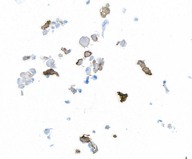 alpha Smooth Muscle Actin Antibody in Immunocytochemistry (ICC/IF)
