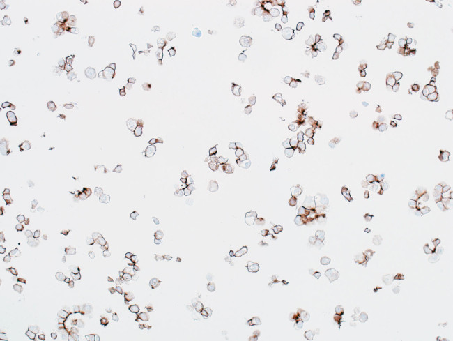 beta Catenin Antibody in Immunocytochemistry (ICC/IF)