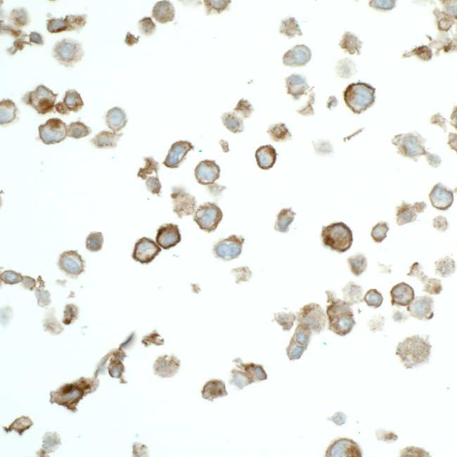 Claudin-1 Antibody in Immunocytochemistry (ICC/IF)