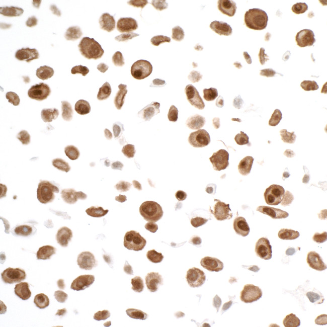 STAT3 Antibody in Immunocytochemistry (ICC/IF)