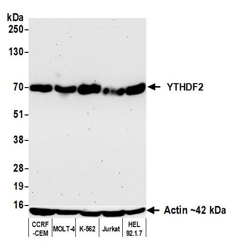 YTHDF2 Antibody in Western Blot (WB)
