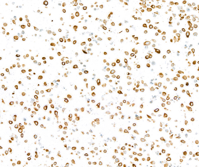 Cytokeratin 8 Antibody in Immunocytochemistry (ICC/IF)