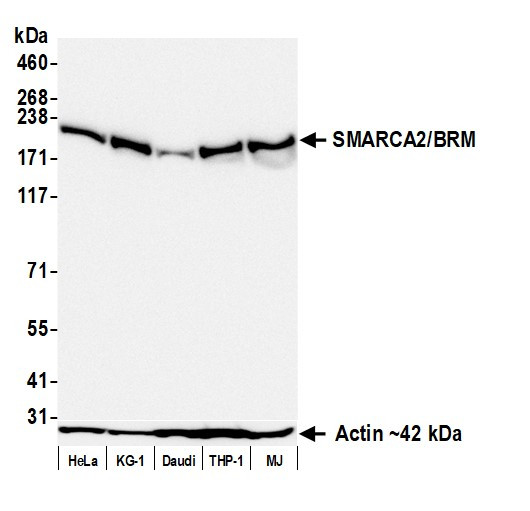 SMARCA2/BRM Antibody in Western Blot (WB)
