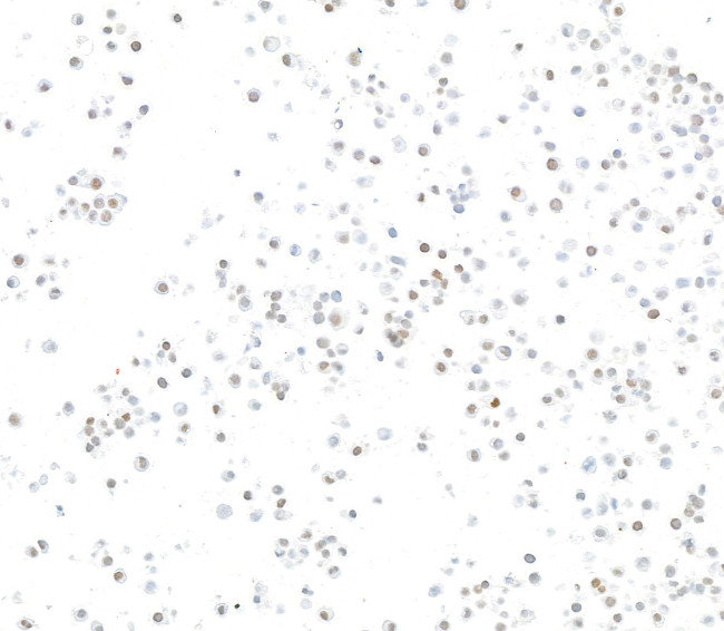 SMARCA2/BRM Antibody in Immunocytochemistry (ICC/IF)
