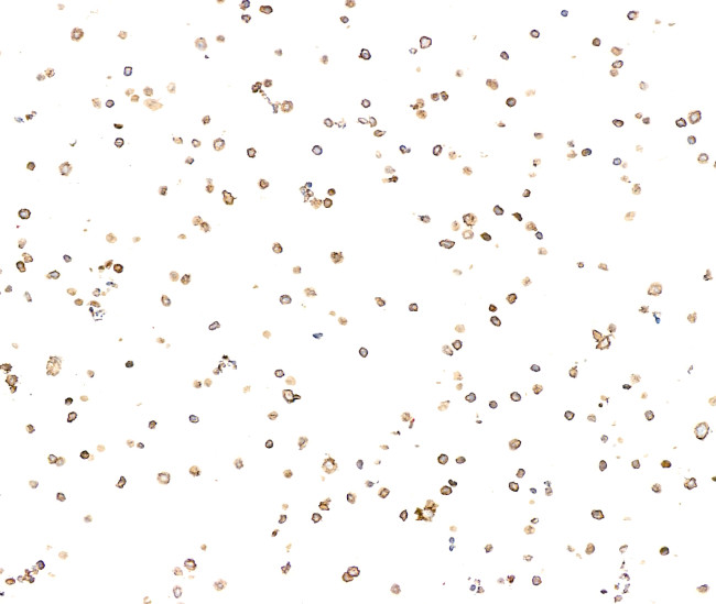 FITC Antibody in Immunocytochemistry (ICC/IF)