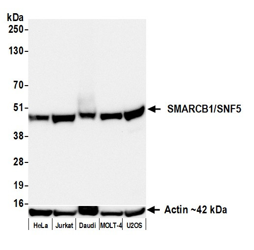 SMARCB1/SNF5 Antibody in Western Blot (WB)