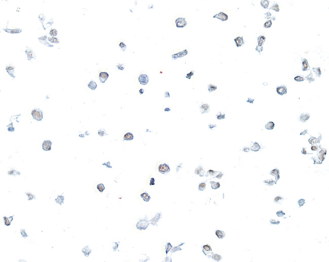SMARCB1/SNF5 Antibody in Immunocytochemistry (ICC/IF)