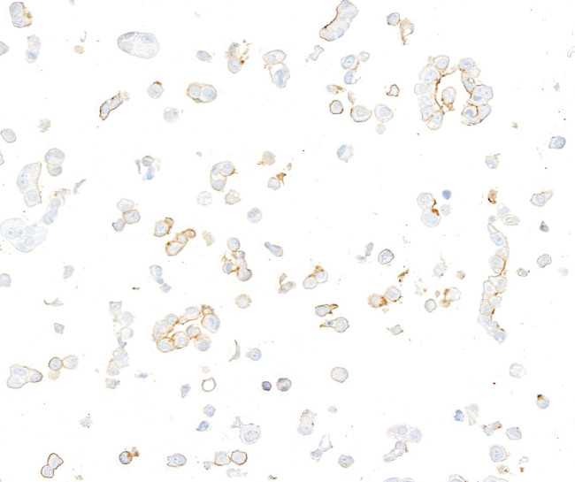Nectin-3 Antibody in Immunocytochemistry (ICC/IF)