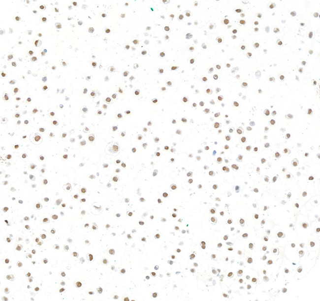 SRF Antibody in Immunocytochemistry (ICC/IF)