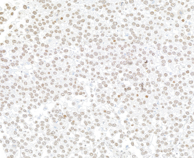 EZH2 Antibody in Immunohistochemistry (Paraffin) (IHC (P))