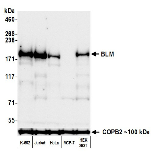 BLM Antibody in Western Blot (WB)