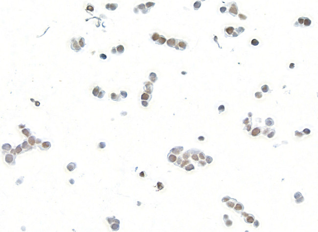 BLM Antibody in Immunocytochemistry (ICC/IF)