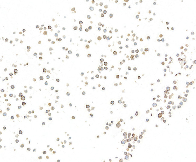 Biotin Antibody in Immunocytochemistry (ICC/IF)