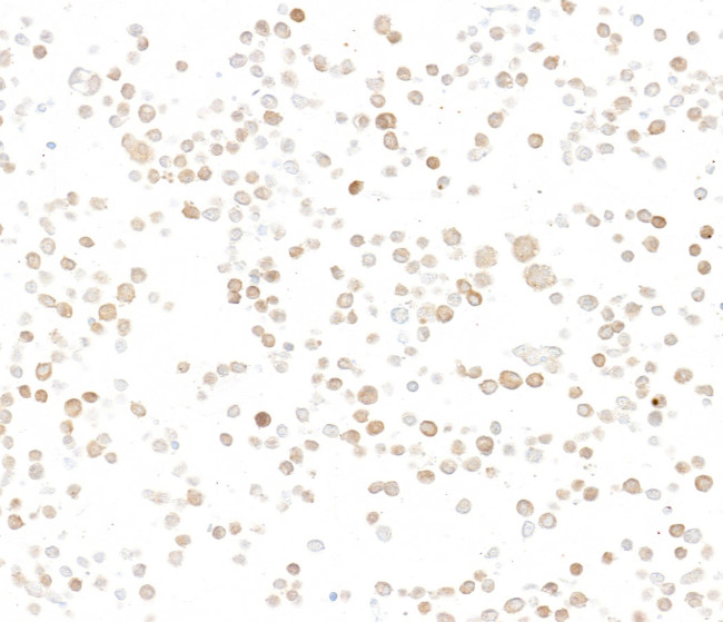 p16INK4a Antibody in Immunocytochemistry (ICC/IF)