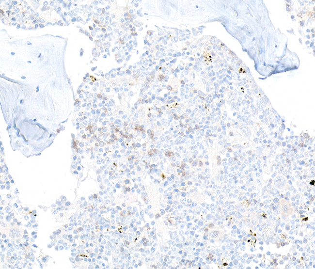CD22 Antibody in Immunohistochemistry (Paraffin) (IHC (P))