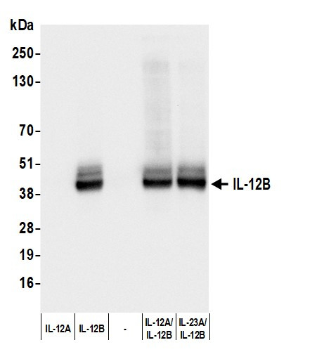 IL-12B Antibody in Western Blot (WB)