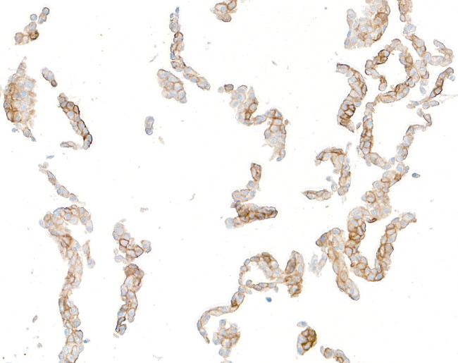 CD138 Antibody in Immunocytochemistry (ICC/IF)