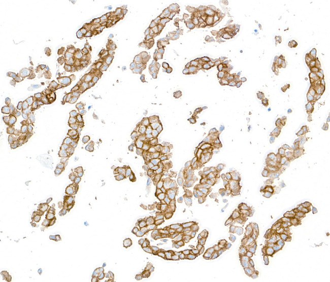 CD138 Antibody in Immunocytochemistry (ICC/IF)