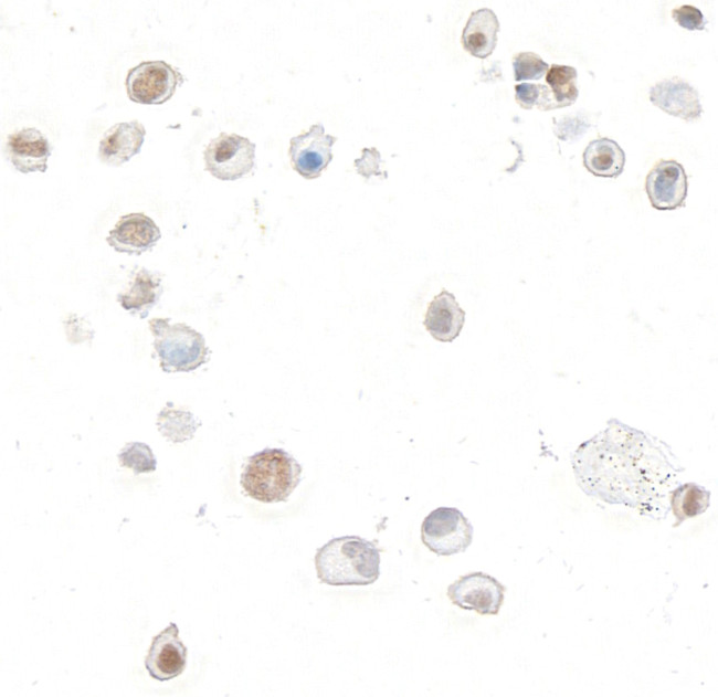 p14ARF Antibody in Immunocytochemistry (ICC/IF)