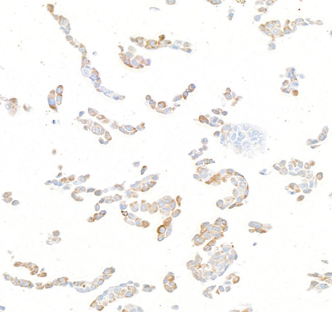 N-Ras Antibody in Immunocytochemistry (ICC/IF)