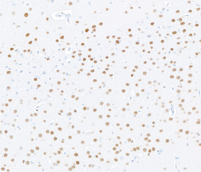 MEF2C Antibody in Immunohistochemistry (Paraffin) (IHC (P))
