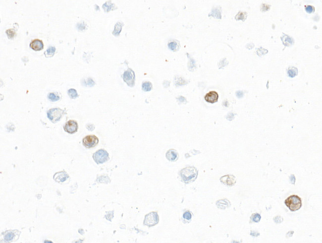 IL-9 Antibody in Immunocytochemistry (ICC/IF)