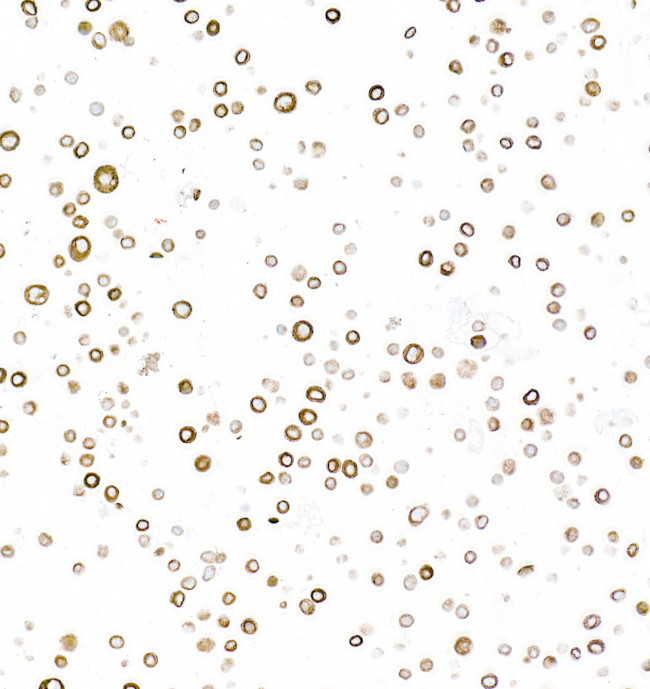 Cytokeratin 5 Antibody in Immunocytochemistry (ICC/IF)