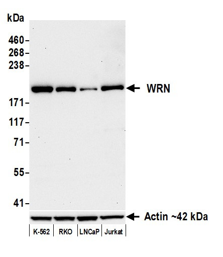 WRN Antibody in Western Blot (WB)
