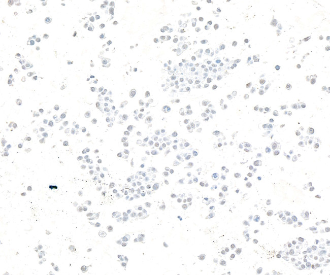 ZC3H4 Antibody in Immunocytochemistry (ICC/IF)