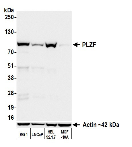 PLZF Antibody in Western Blot (WB)