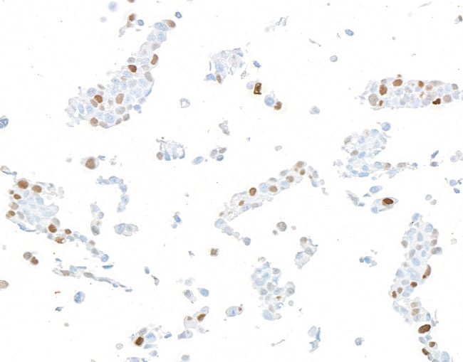 p21/CIP1/CDKN1A Antibody in Immunocytochemistry (ICC/IF)