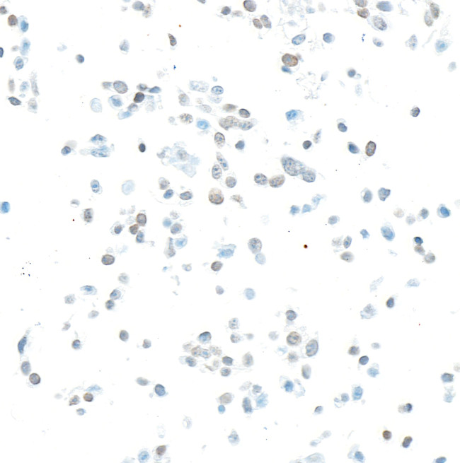 EZH2 Antibody in Immunocytochemistry (ICC/IF)