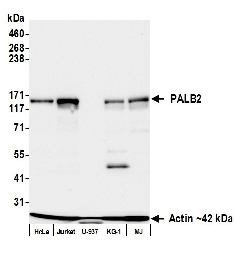 PALB2 Antibody in Western Blot (WB)