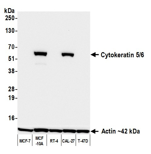 Cytokeratin 5/6 Antibody in Western Blot (WB)