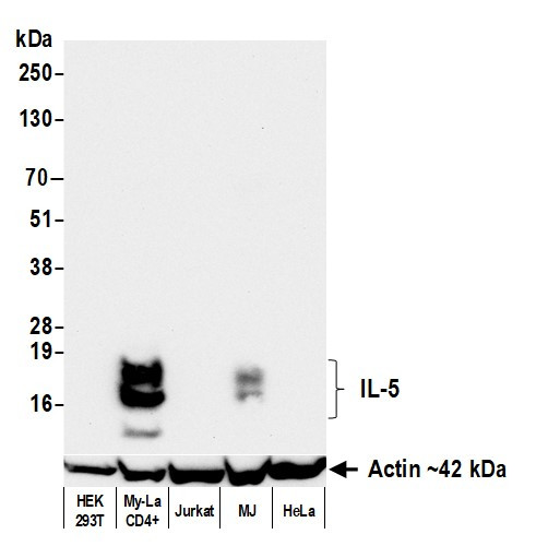 IL-5 Antibody in Western Blot (WB)