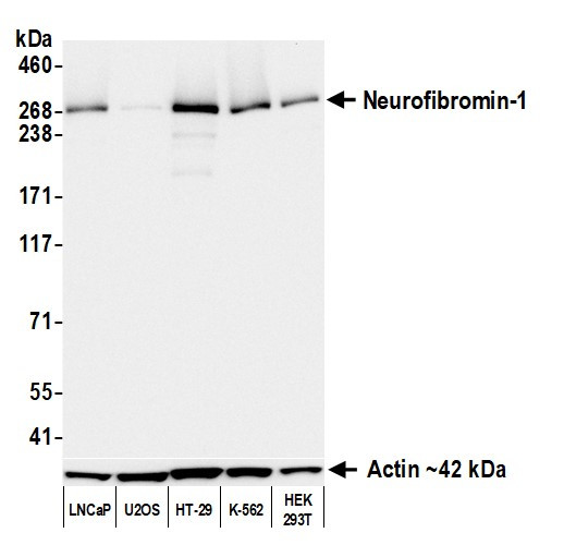 Neurofibromin 1 Antibody in Western Blot (WB)