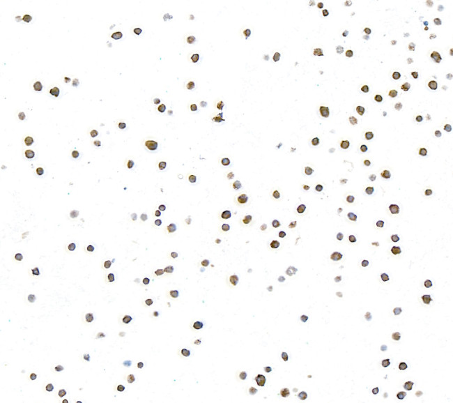 NF-kappaB2 (p100/p52) Antibody in Immunocytochemistry (ICC/IF)