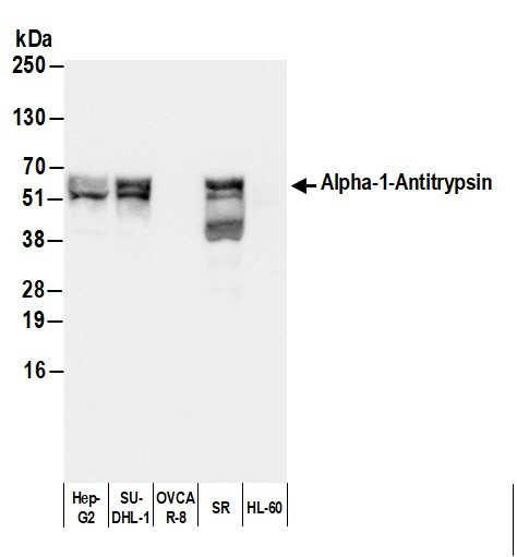 Human Alpha-1-Antitrypsin Antibody in Western Blot (WB)