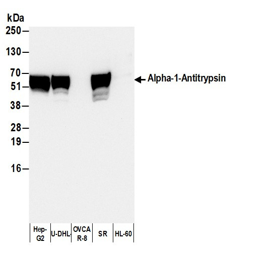 Human Alpha-1-Antitrypsin Antibody in Western Blot (WB)