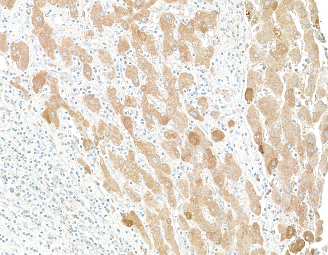 Human C-Reactive Protein (CRP) Antibody in Immunohistochemistry (Paraffin) (IHC (P))