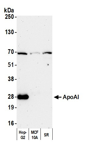 ApoAI Antibody in Western Blot (WB)