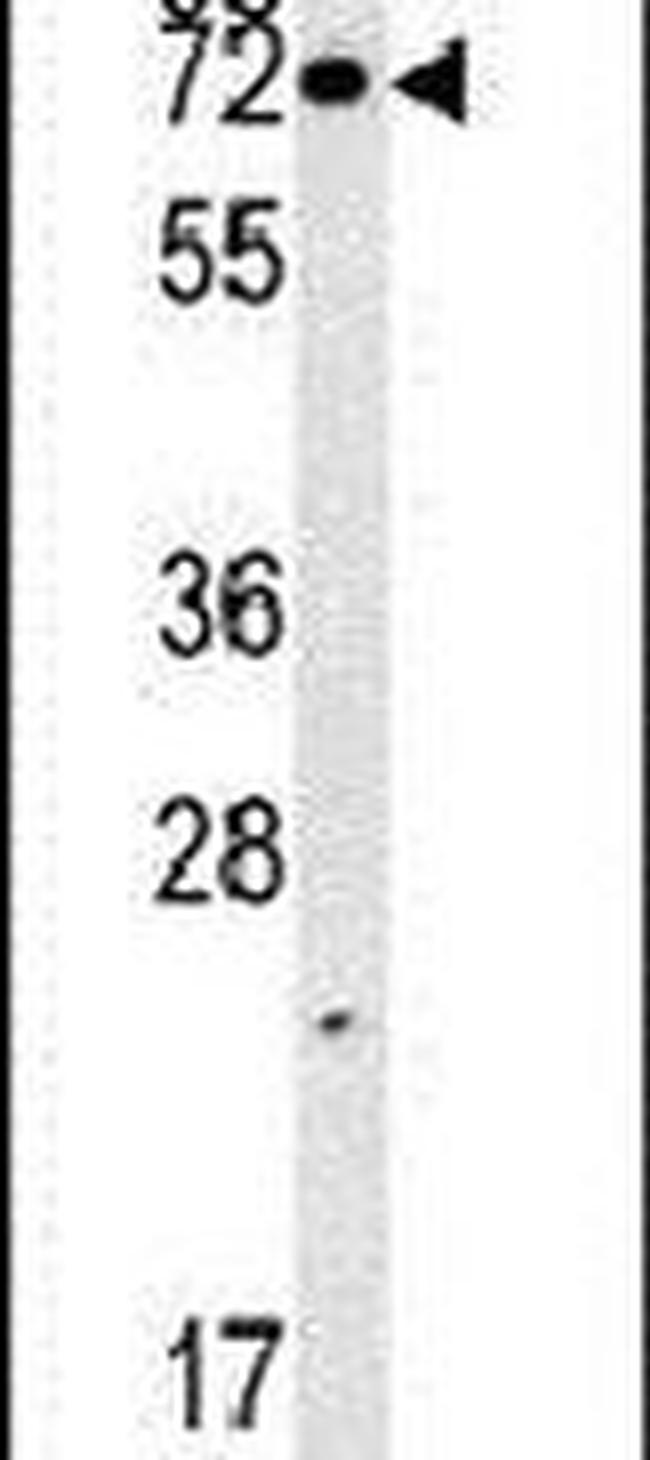 SLC7A10 Antibody in Western Blot (WB)
