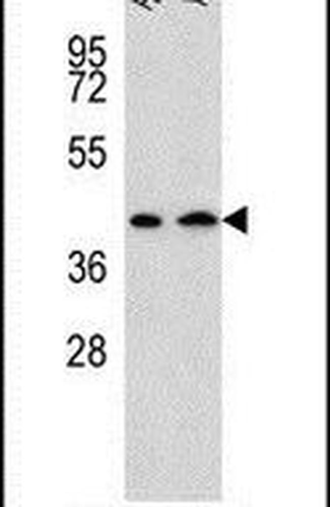 AADAT Antibody in Western Blot (WB)