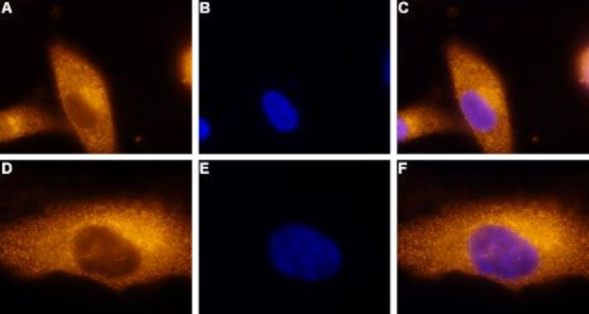 Adenosine A3 Receptor Antibody in Immunocytochemistry (ICC/IF)