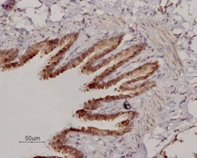 beta 2-Adrenergic Receptor (extracellular) Antibody in Immunohistochemistry (Paraffin) (IHC (P))