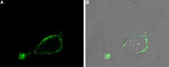 Adenylate Cyclase 3 (AC3) (extracellular) Antibody in Immunocytochemistry (ICC/IF)